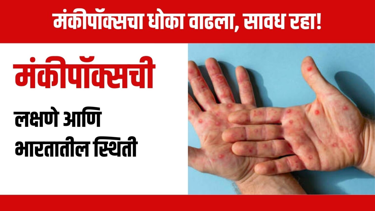 Monkeypox Symptoms: मंकीपॉक्सची लक्षणे आणि भारतातील स्थिती