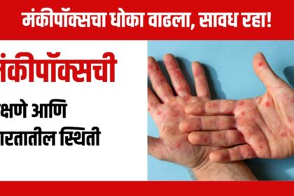Monkeypox Symptoms: मंकीपॉक्सची लक्षणे आणि भारतातील स्थिती